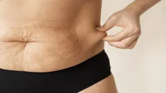 50歳を過ぎるとお腹の脂肪は自然に消えてはくれない――隠れた脂肪燃焼モードを活性化させる方法